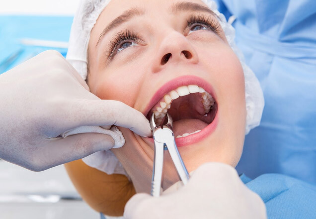 Estrazione dei denti con la sedazione
