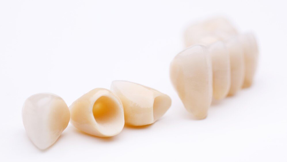 Protesi Corona dentale