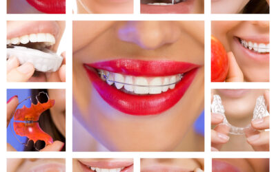 Igiene dentale per pazienti ortodontici portatori di apparecchio dentale